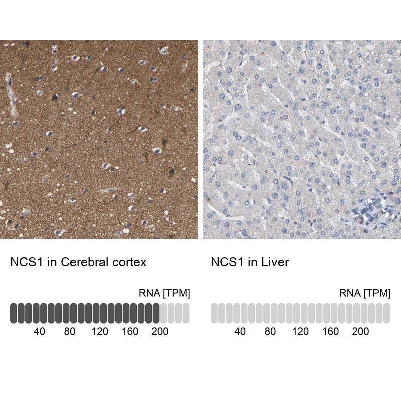 Immunohistochemistry analysis in human cerebral cortex and liver tissues using Anti-NCS1 antibody. Corresponding NCS1 RNA-seq data are presented for the same tissues.