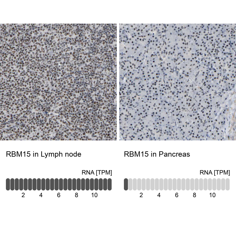 Immunohistochemistry analysis in human lymph node and pancreas tissues using HPA019824 antibody. Corresponding RBM15 RNA-seq data are presented for the same tissues.