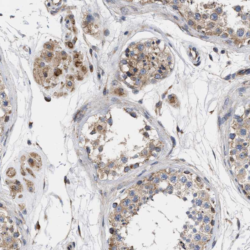 Immunohistochemical staining of human testis shows strong granular cytoplasmic positivity in Leydig cells.