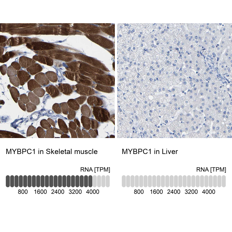 Immunohistochemistry analysis in human skeletal muscle and liver tissues using Anti-MYBPC1 antibody. Corresponding MYBPC1 RNA-seq data are presented for the same tissues.
