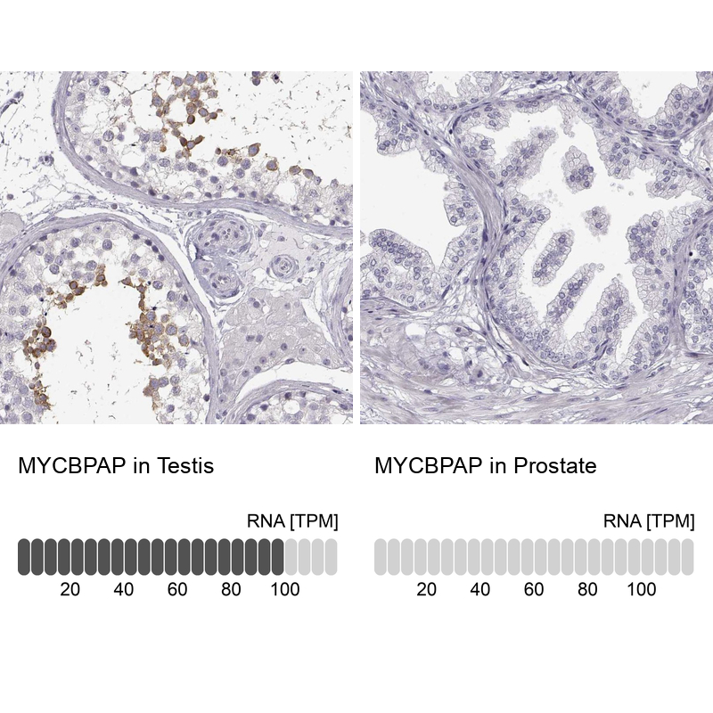 Immunohistochemistry analysis in human testis and prostate tissues using Anti-MYCBPAP antibody. Corresponding MYCBPAP RNA-seq data are presented for the same tissues.