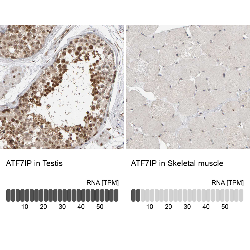 Immunohistochemistry analysis in human testis and skeletal muscle tissues using HPA023505 antibody. Corresponding ATF7IP RNA-seq data are presented for the same tissues.