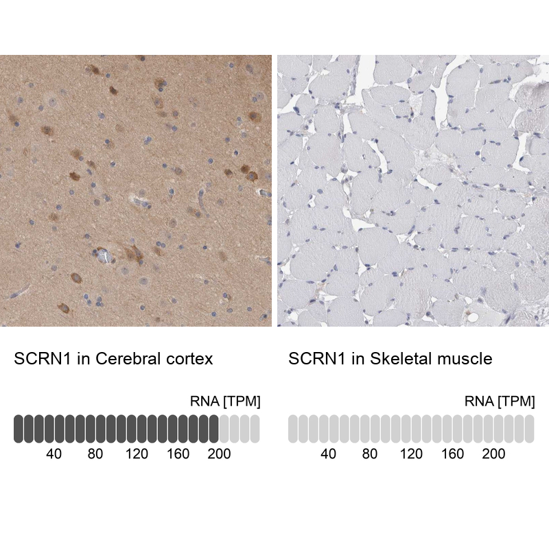Immunohistochemistry analysis in human cerebral cortex and skeletal muscle tissues using Anti-SCRN1 antibody. Corresponding SCRN1 RNA-seq data are presented for the same tissues.