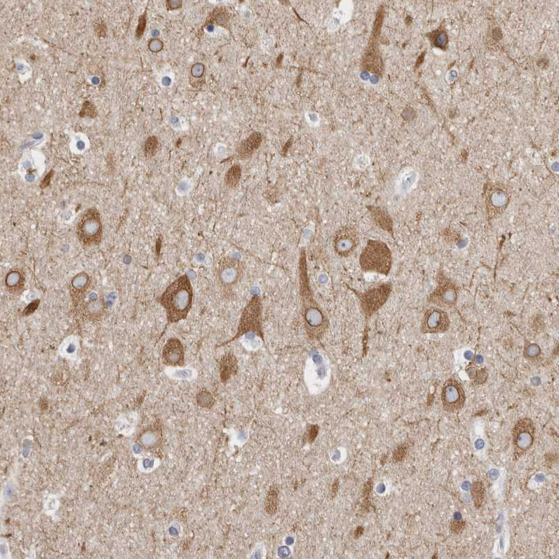 Immunohistochemical staining of human cerebral cortex shows moderate cytoplasmic and membranous positivity in neurons.