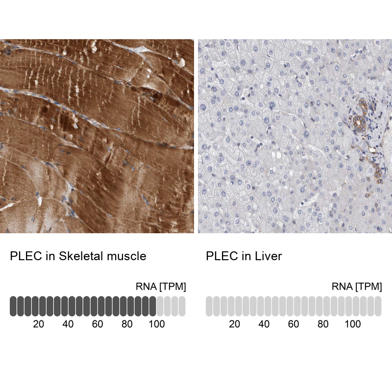 Immunohistochemistry analysis in human skeletal muscle and liver tissues using HPA025967 antibody. Corresponding PLEC RNA-seq data are presented for the same tissues.
