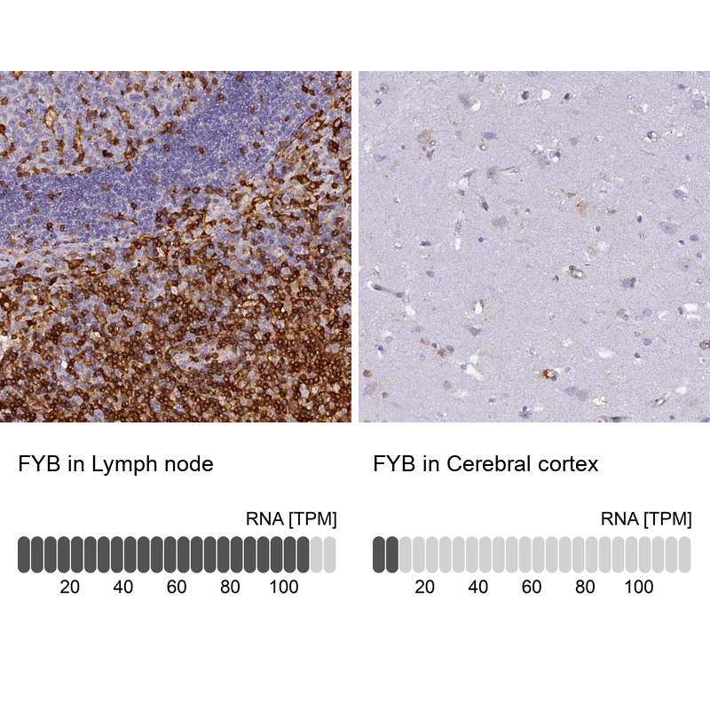 Immunohistochemistry analysis in human lymph node and cerebral cortex tissues using Anti-FYB antibody. Corresponding FYB RNA-seq data are presented for the same tissues.
