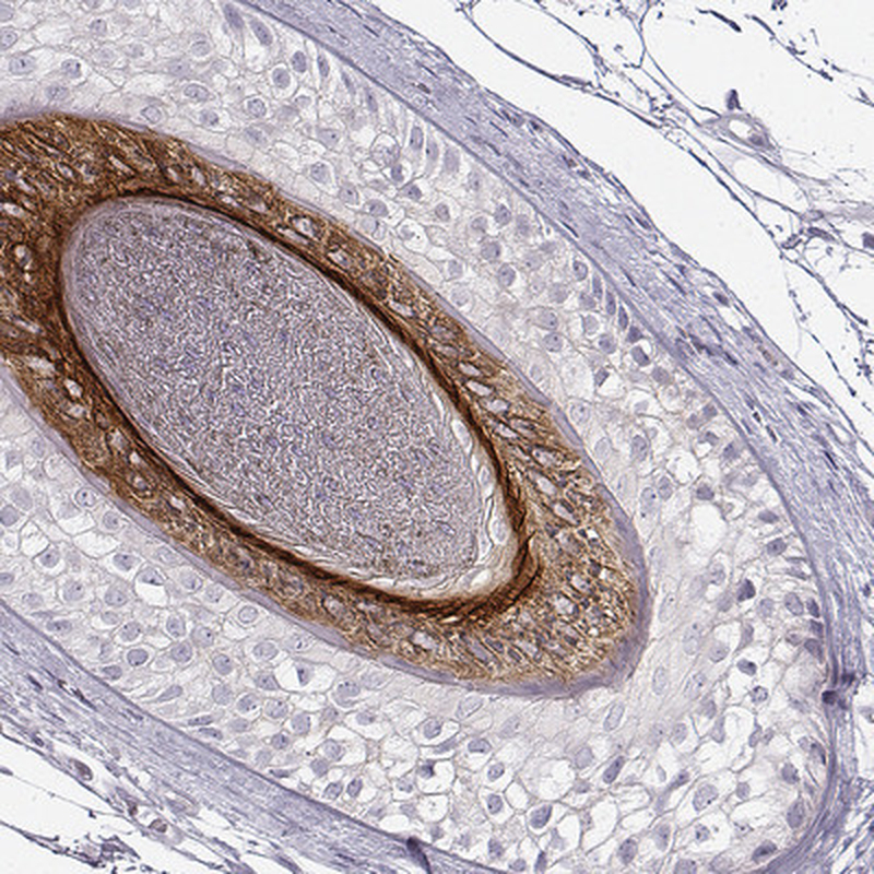 Immunohistochemical staining of human hair shows strong cytoplasmic positivity in internal root sheath.