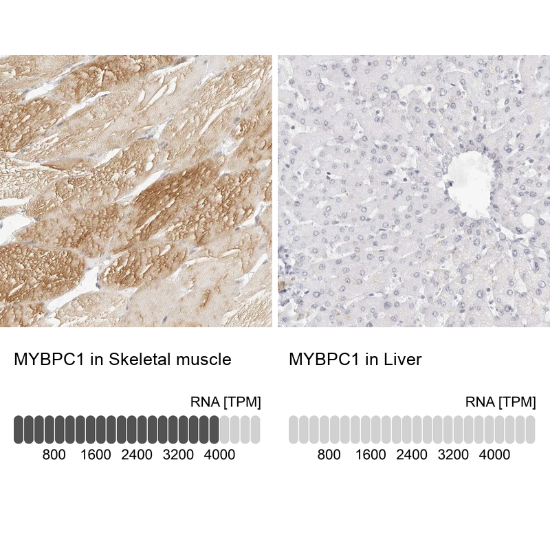 Immunohistochemistry analysis in human skeletal muscle and liver tissues using Anti-MYBPC1 antibody. Corresponding MYBPC1 RNA-seq data are presented for the same tissues.