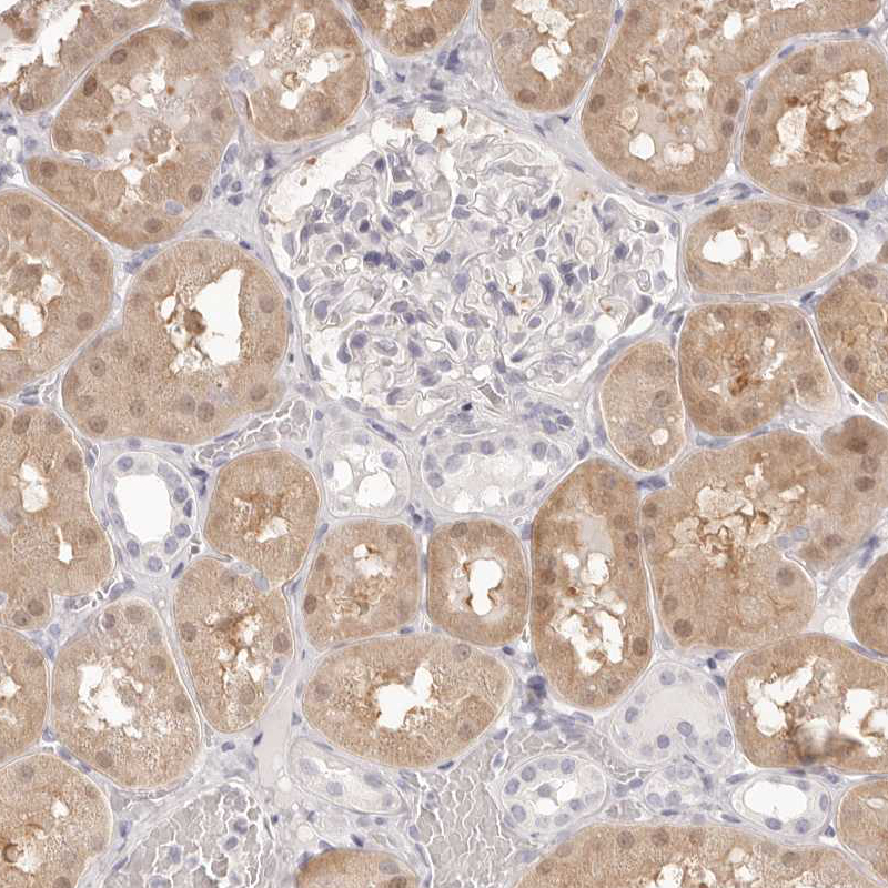 Immunohistochemical staining of human kidney shows weak cytoplasmic positivity in cells in tubules.