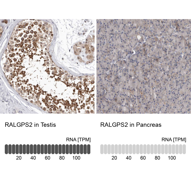 Immunohistochemistry analysis in human testis and pancreas tissues using Anti-RALGPS2 antibody. Corresponding RALGPS2 RNA-seq data are presented for the same tissues.