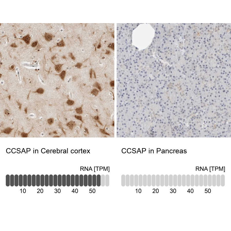 Immunohistochemistry analysis in human cerebral cortex and pancreas tissues using Anti-CCSAP antibody. Corresponding CCSAP RNA-seq data are presented for the same tissues.