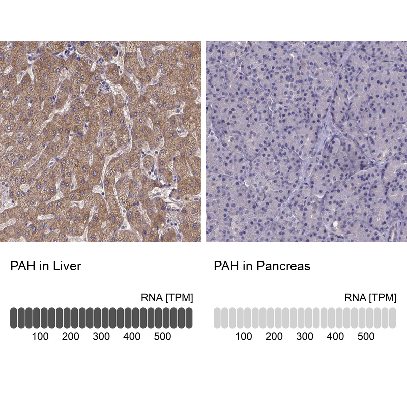 Immunohistochemistry analysis in human liver and pancreas tissues using HPA028407 antibody. Corresponding PAH RNA-seq data are presented for the same tissues.