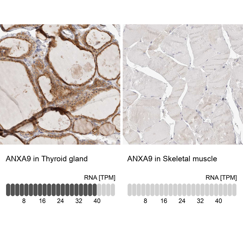 Immunohistochemistry analysis in human thyroid gland and skeletal muscle tissues using Anti-ANXA9 antibody. Corresponding ANXA9 RNA-seq data are presented for the same tissues.