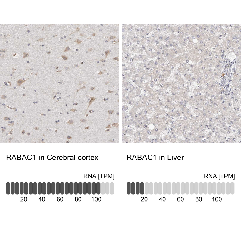Immunohistochemistry analysis in human cerebral cortex and liver tissues using Anti-RABAC1 antibody. Corresponding RABAC1 RNA-seq data are presented for the same tissues.