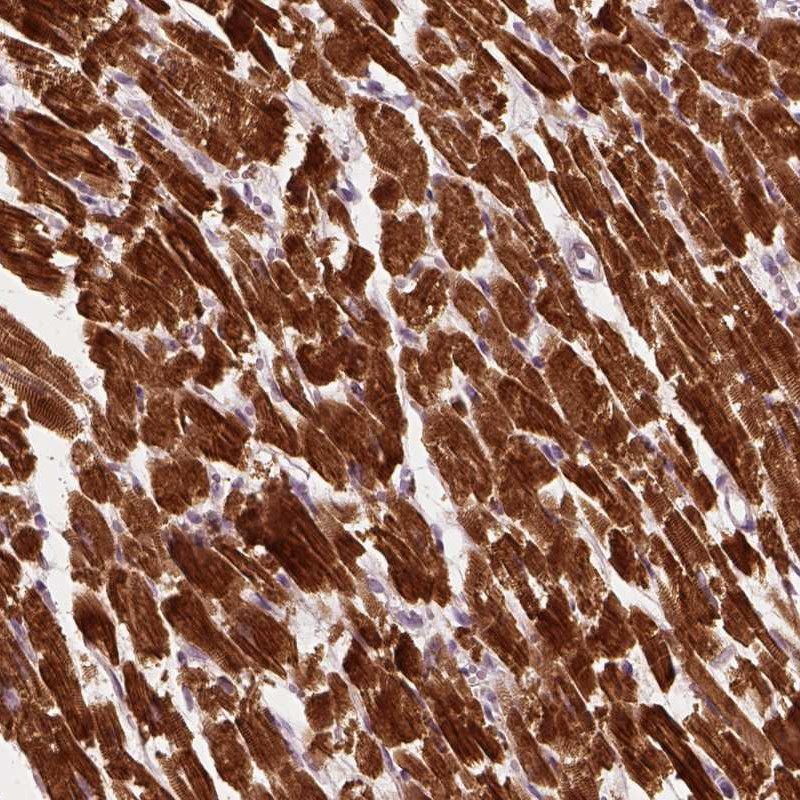 Immunohistochemical staining of human heart muscle shows cytoplasmic positivity in myocytes.