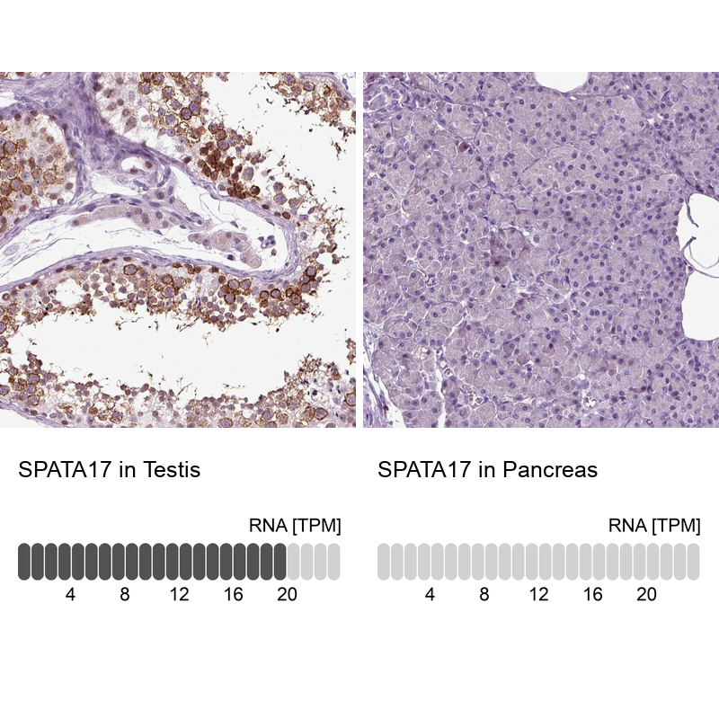 Immunohistochemistry analysis in human testis and pancreas tissues using Anti-SPATA17 antibody. Corresponding SPATA17 RNA-seq data are presented for the same tissues.
