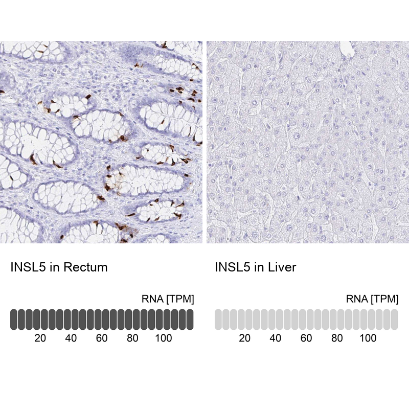 Immunohistochemistry analysis in human rectum and liver tissues using Anti-INSL5 antibody. Corresponding INSL5 RNA-seq data are presented for the same tissues.