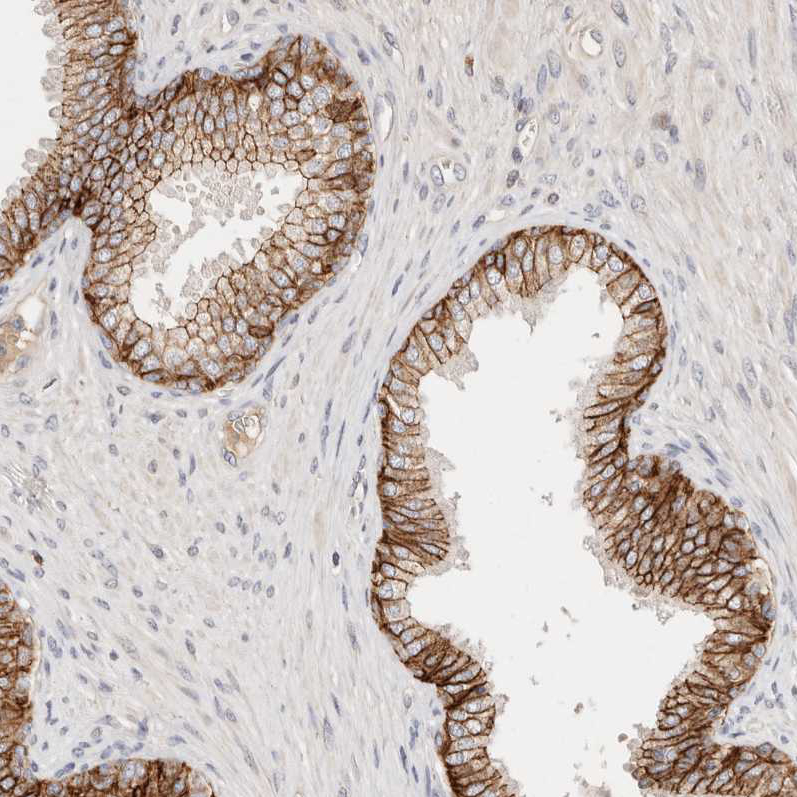 Immunohistochemical staining of human prostate shows strong membranous positivity in glandular cells.