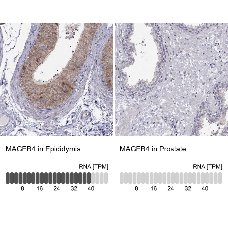 Immunohistochemistry analysis in human epididymis and prostate tissues using Anti-MAGEB4 antibody. Corresponding MAGEB4 RNA-seq data are presented for the same tissues.