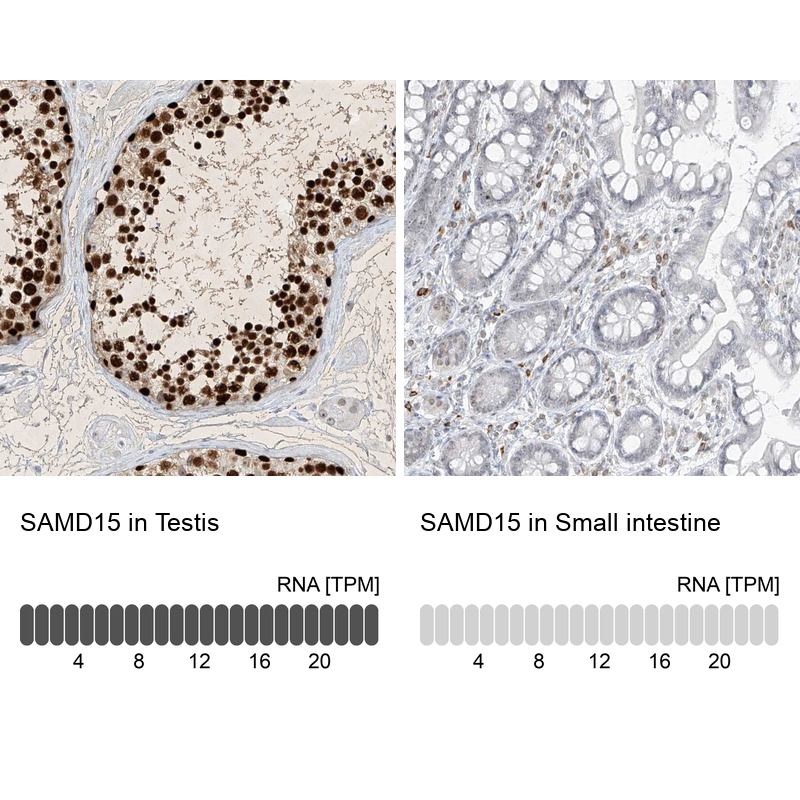 Immunohistochemistry analysis in human testis and small intestine tissues using Anti-SAMD15 antibody. Corresponding SAMD15 RNA-seq data are presented for the same tissues.
