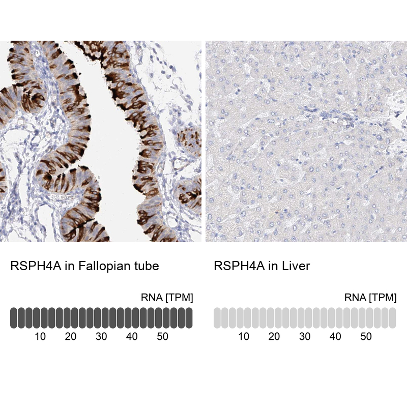 Immunohistochemistry analysis in human fallopian tube and liver tissues using Anti-RSPH4A antibody. Corresponding RSPH4A RNA-seq data are presented for the same tissues.