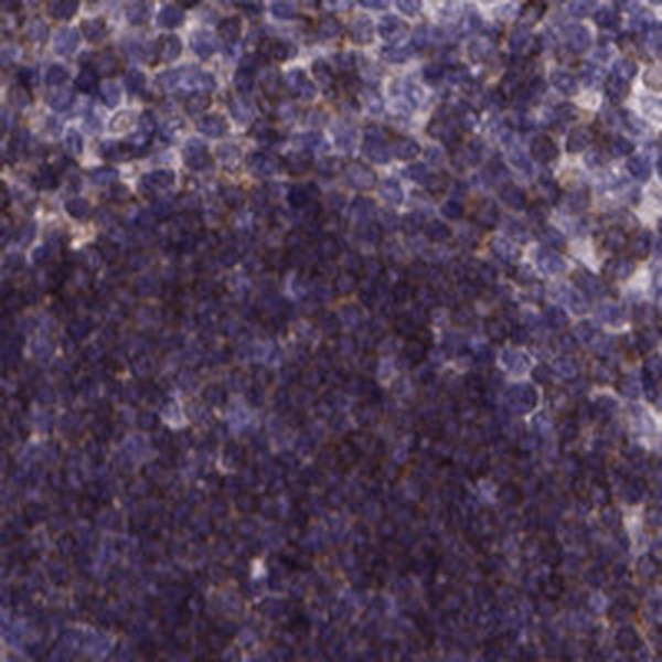 Immunohistochemical staining of human thymus shows strong cytoplasmic positivity in cortical cells.