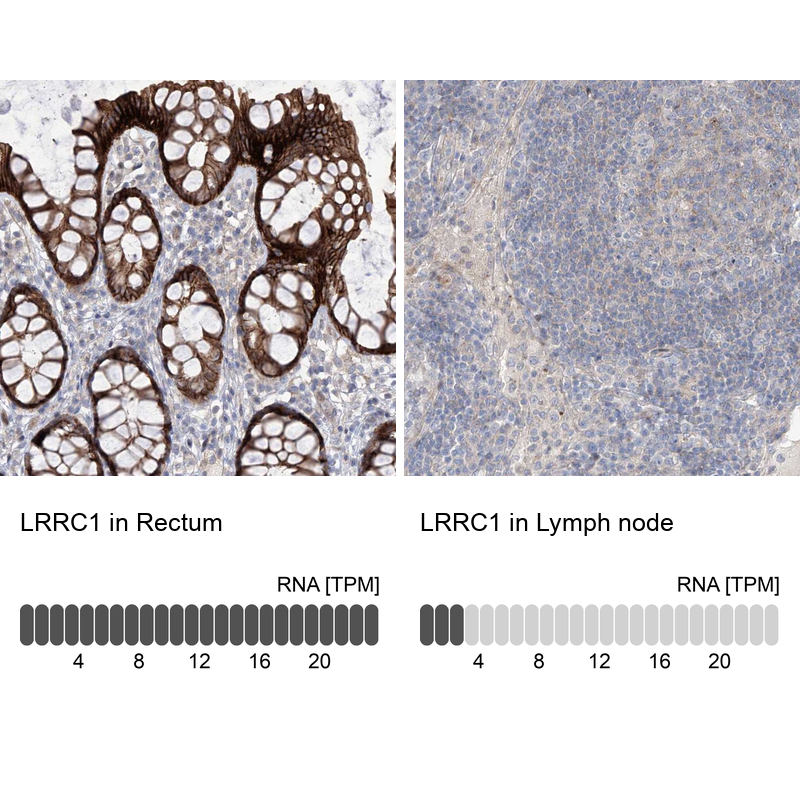 Immunohistochemistry analysis in human rectum and lymph node tissues using Anti-LRRC1 antibody. Corresponding LRRC1 RNA-seq data are presented for the same tissues.