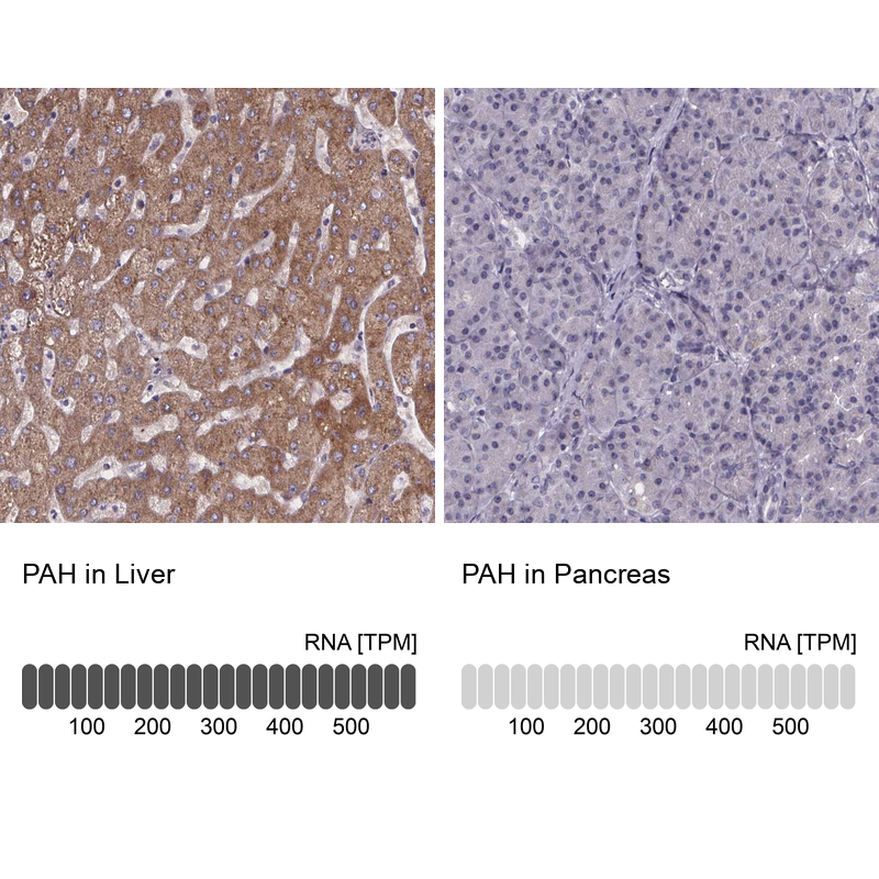 Immunohistochemistry analysis in human liver and pancreas tissues using HPA031642 antibody. Corresponding PAH RNA-seq data are presented for the same tissues.