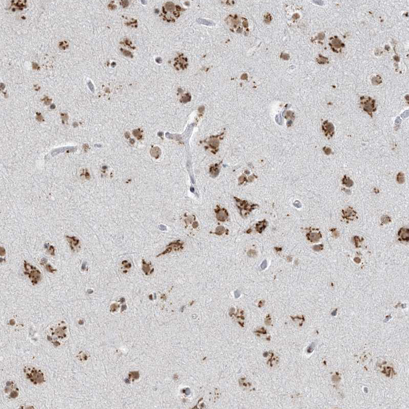 Immunohistochemical staining of human cerebral cortex shows strong positivity in Golgi apparatus in neurons.