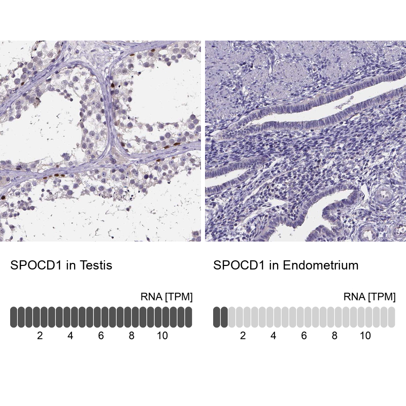 Immunohistochemistry analysis in human testis and endometrium tissues using Anti-SPOCD1 antibody. Corresponding SPOCD1 RNA-seq data are presented for the same tissues.