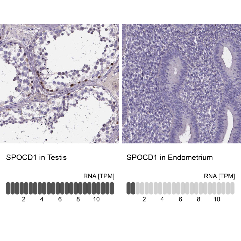 Immunohistochemistry analysis in human testis and endometrium tissues using Anti-SPOCD1 antibody. Corresponding SPOCD1 RNA-seq data are presented for the same tissues.