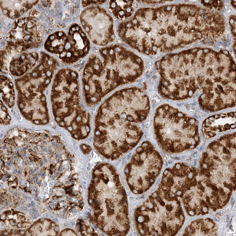 Immunohistochemical staining of human kidney shows strong granular cytoplasmic positivity in cells in tubules.