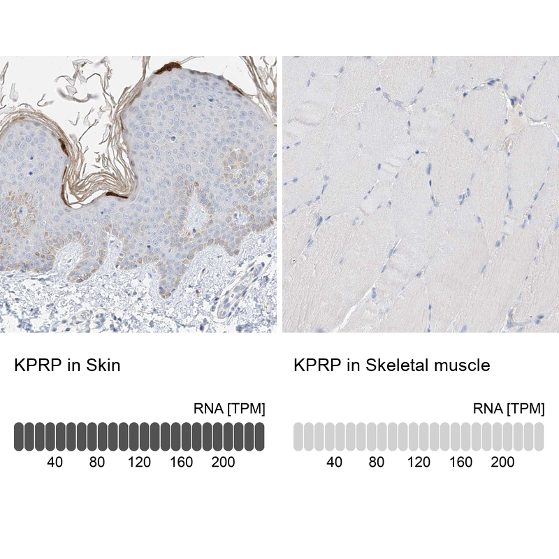 Immunohistochemistry analysis in human skin and skeletal muscle tissues using Anti-KPRP antibody. Corresponding KPRP RNA-seq data are presented for the same tissues.
