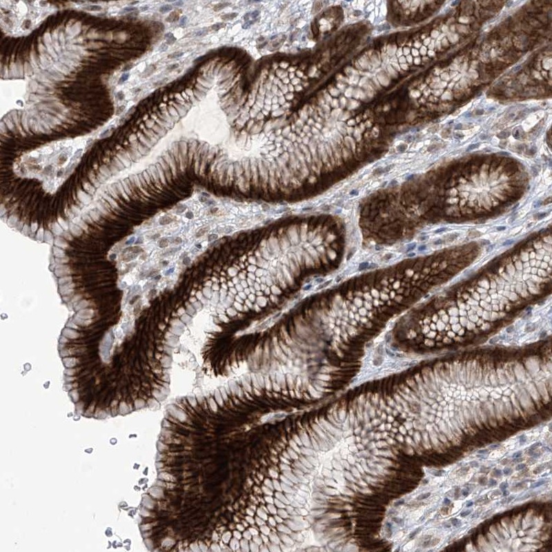 Immunohistochemical staining of human stomach, upper shows strong cytoplasmic and membranous positivity in glandular cells.