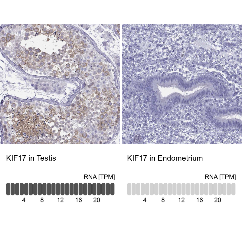 Immunohistochemistry analysis in human testis and endometrium tissues using Anti-KIF17 antibody. Corresponding KIF17 RNA-seq data are presented for the same tissues.