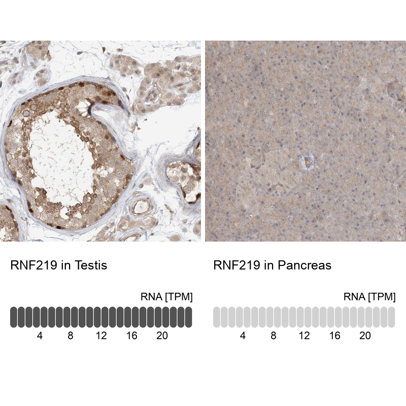 Immunohistochemistry analysis in human testis and pancreas tissues using Anti-RNF219 antibody. Corresponding RNF219 RNA-seq data are presented for the same tissues.