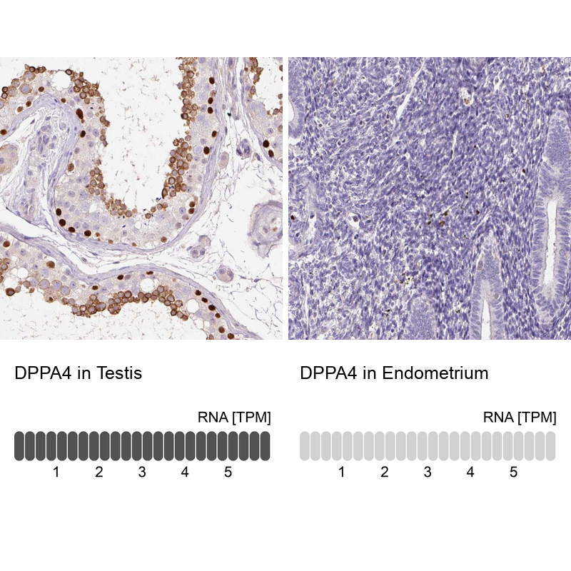 Immunohistochemistry analysis in human testis and endometrium tissues using Anti-DPPA4 antibody. Corresponding DPPA4 RNA-seq data are presented for the same tissues.