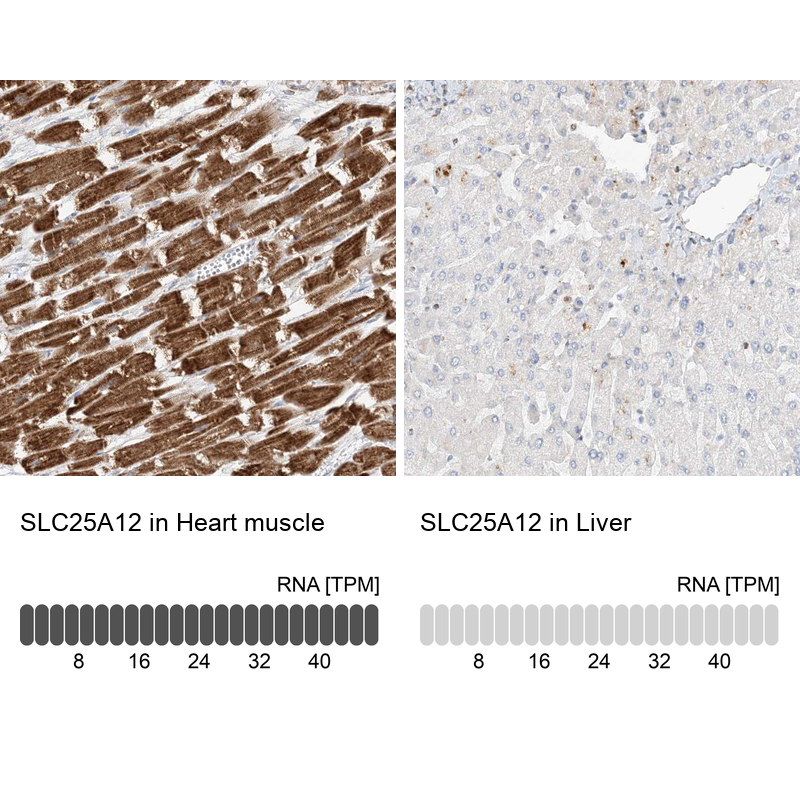 Immunohistochemistry analysis in human heart muscle and liver tissues using Anti-SLC25A12 antibody. Corresponding SLC25A12 RNA-seq data are presented for the same tissues.