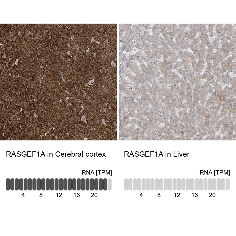 Immunohistochemistry analysis in human cerebral cortex and liver tissues using Anti-RASGEF1A antibody. Corresponding RASGEF1A RNA-seq data are presented for the same tissues.