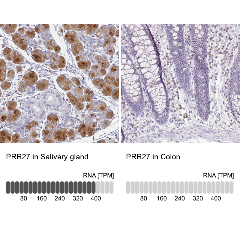 Immunohistochemistry analysis in human salivary gland and colon tissues using Anti-PRR27 antibody. Corresponding PRR27 RNA-seq data are presented for the same tissues.
