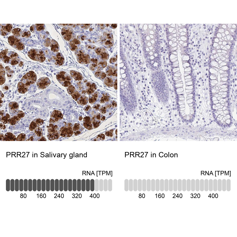 Immunohistochemistry analysis in human salivary gland and colon tissues using Anti-PRR27 antibody. Corresponding PRR27 RNA-seq data are presented for the same tissues.