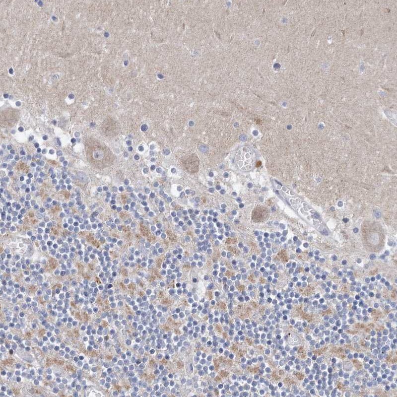 Immunohistochemical staining of human cerebellum shows moderat cytoplsmic positivity in cells in granular layer.