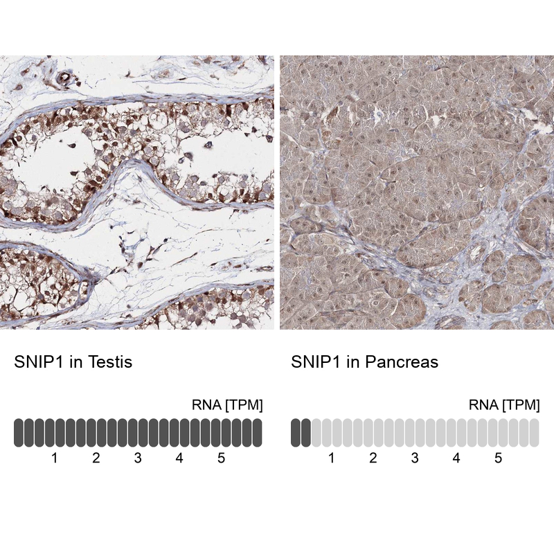 Immunohistochemistry analysis in human testis and pancreas tissues using Anti-SNIP1 antibody. Corresponding SNIP1 RNA-seq data are presented for the same tissues.