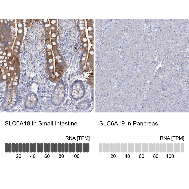 Immunohistochemistry analysis in human small intestine and pancreas tissues using Anti-SLC6A19 antibody. Corresponding SLC6A19 RNA-seq data are presented for the same tissues.