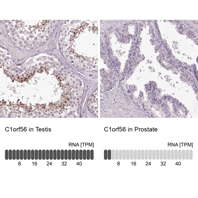 Immunohistochemistry analysis in human testis and prostate tissues using Anti-C1orf56 antibody. Corresponding C1orf56 RNA-seq data are presented for the same tissues.