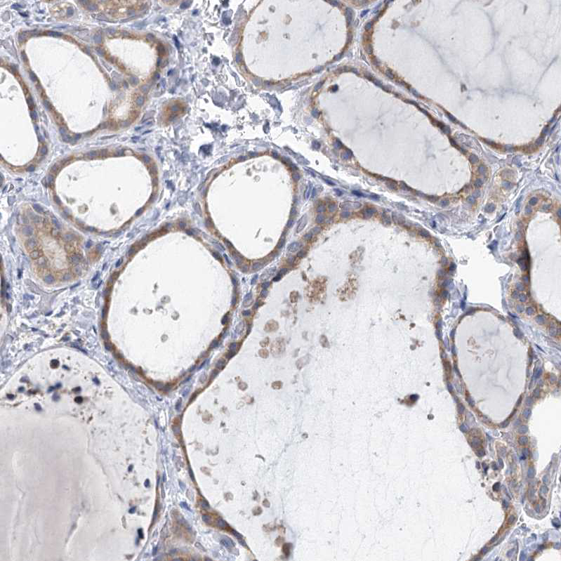 Immunohistochemical staining of human thyroid gland shows moderate cytoplasmic positivity in glandular cells.