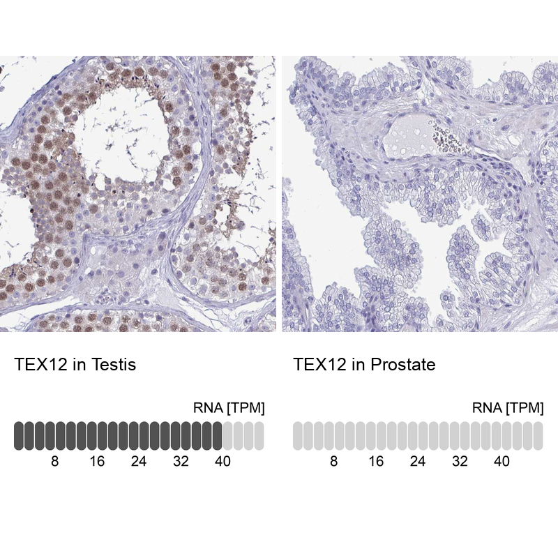 Immunohistochemistry analysis in human testis and prostate tissues using Anti-TEX12 antibody. Corresponding TEX12 RNA-seq data are presented for the same tissues.