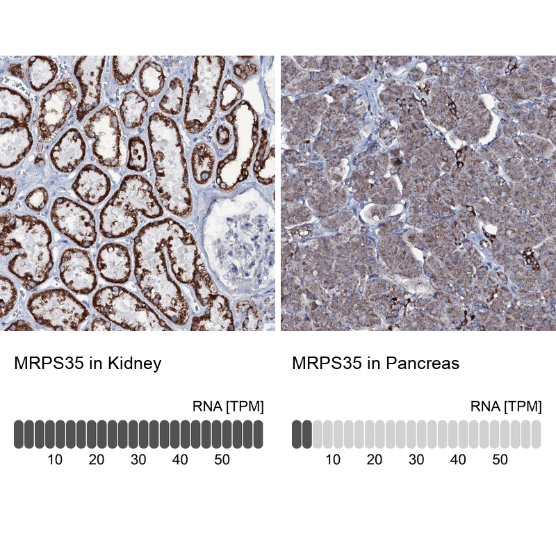 Immunohistochemistry analysis in human kidney and pancreas tissues using Anti-MRPS35 antibody. Corresponding MRPS35 RNA-seq data are presented for the same tissues.