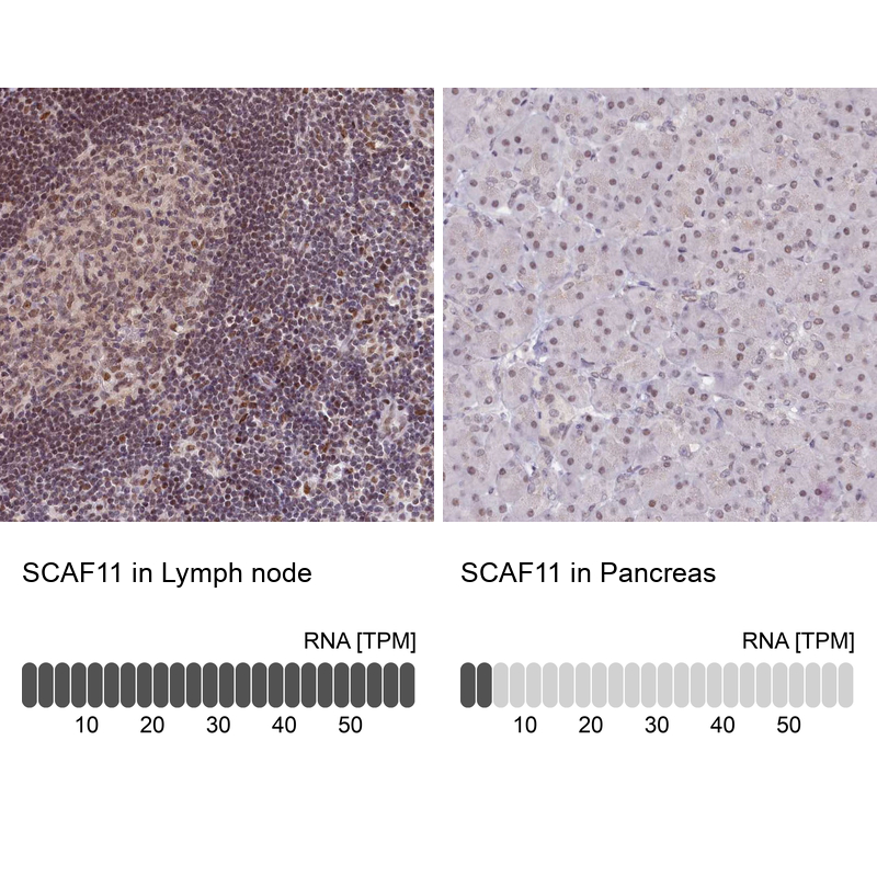 Immunohistochemistry analysis in human lymph node and pancreas tissues using Anti-SCAF11 antibody. Corresponding SCAF11 RNA-seq data are presented for the same tissues.