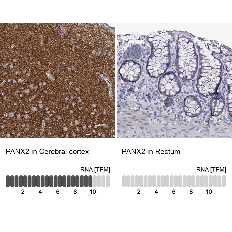 Immunohistochemistry analysis in human cerebral cortex and rectum tissues using Anti-PANX2 antibody. Corresponding PANX2 RNA-seq data are presented for the same tissues.